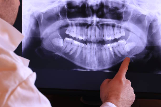 Tooth Infection Emergency Dentist in NY